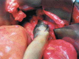 eel inside man's rectum