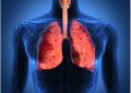 Asthma Causes, Signs, Treatment and Prevention