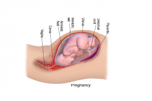 infection during Pregnancy