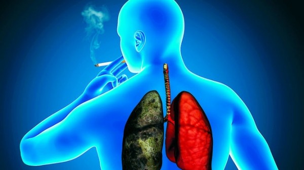 Small Cell Lung Cancer Risk Factors, Symptoms, Treatment & Prevention