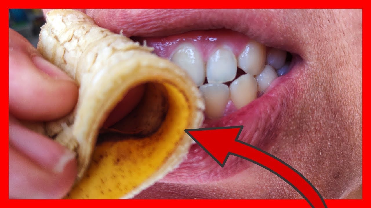 Teeth whitening with banana