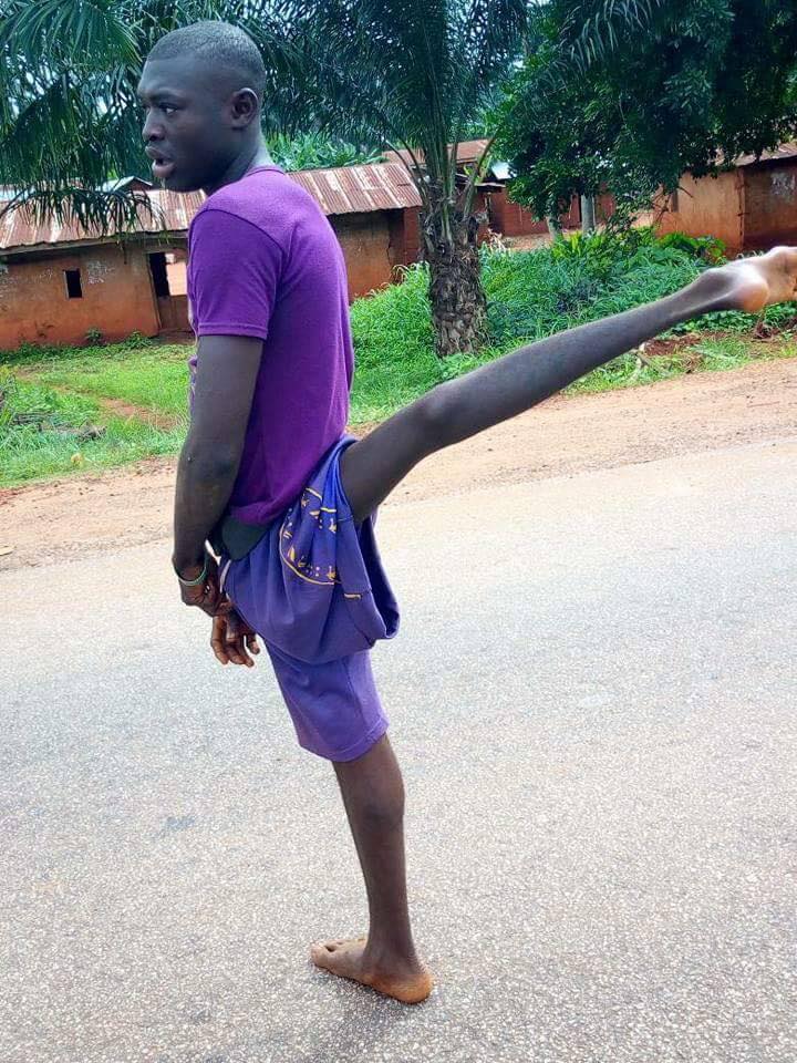 Nigerian Man with Leg Hanging in Air