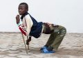 African Boy Legs Bent Backward