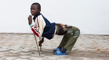 African Boy Legs Bent Backward