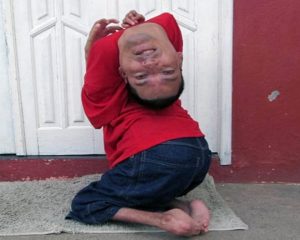 Man with Upside-down Head 