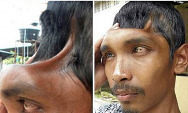Amazing survival