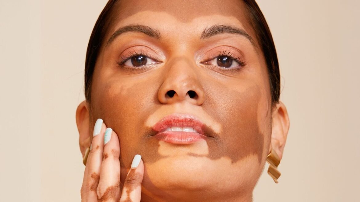 Is Skin Positivity Going The Same Way As Body Positivity?