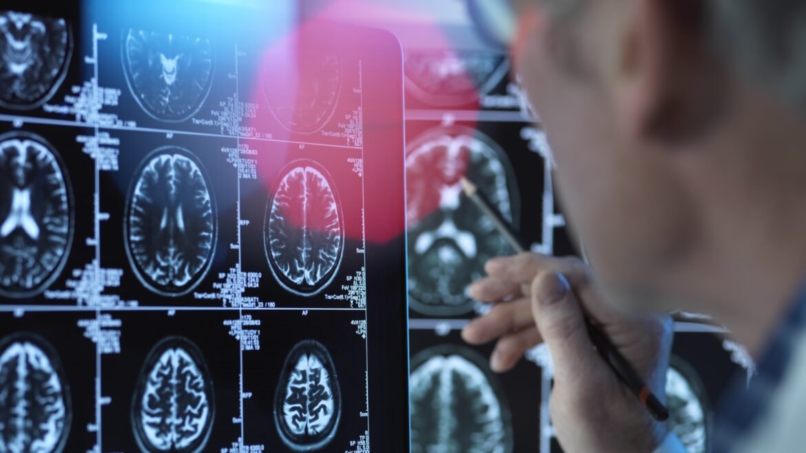 100% fatal brain disease strikes 3 people in Oregon 100% fatal brain disease strikes 3 people in Oregon