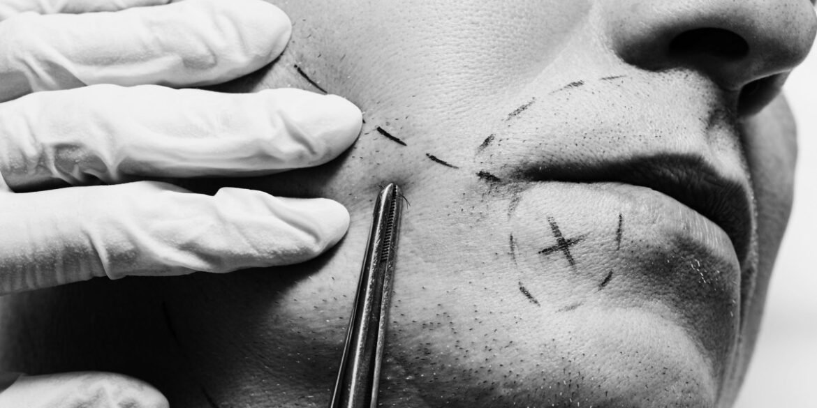 Longevity clinics around the world are selling unproven treatments