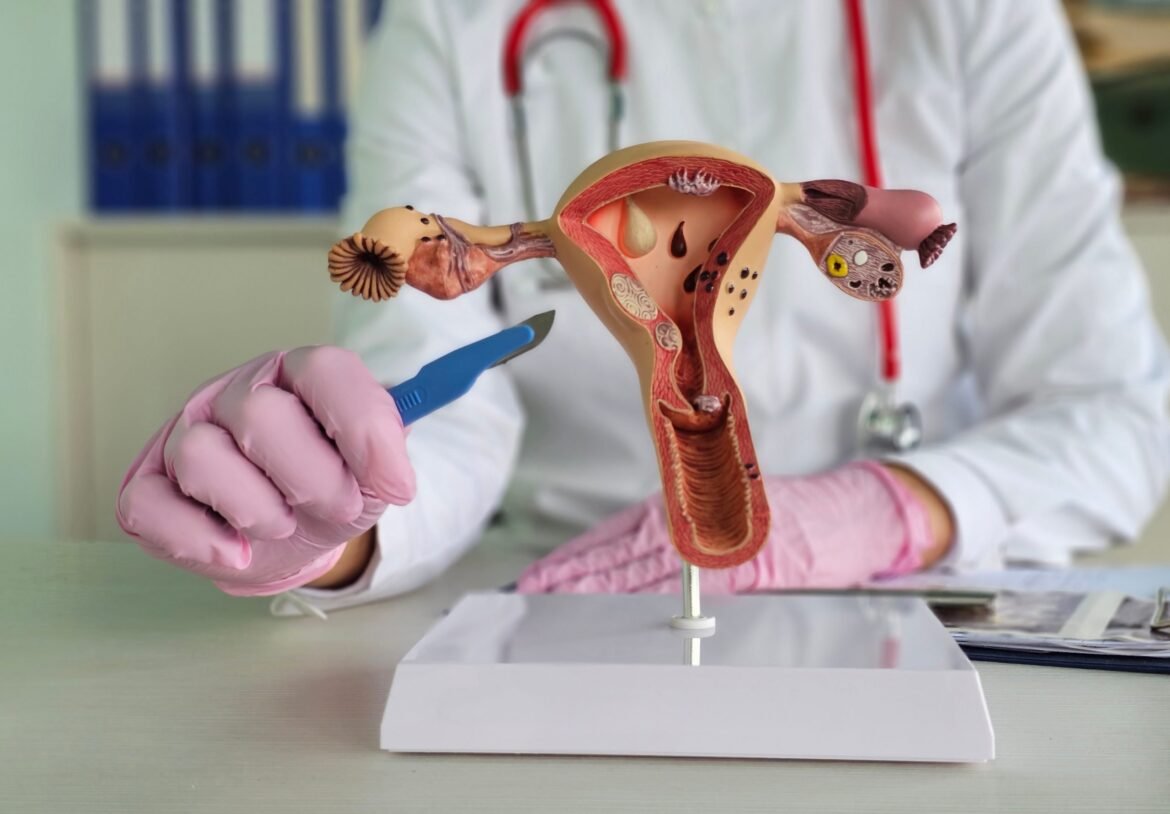 Recovering from Uterine Prolapse Surgery: An Honest, Unfiltered Account