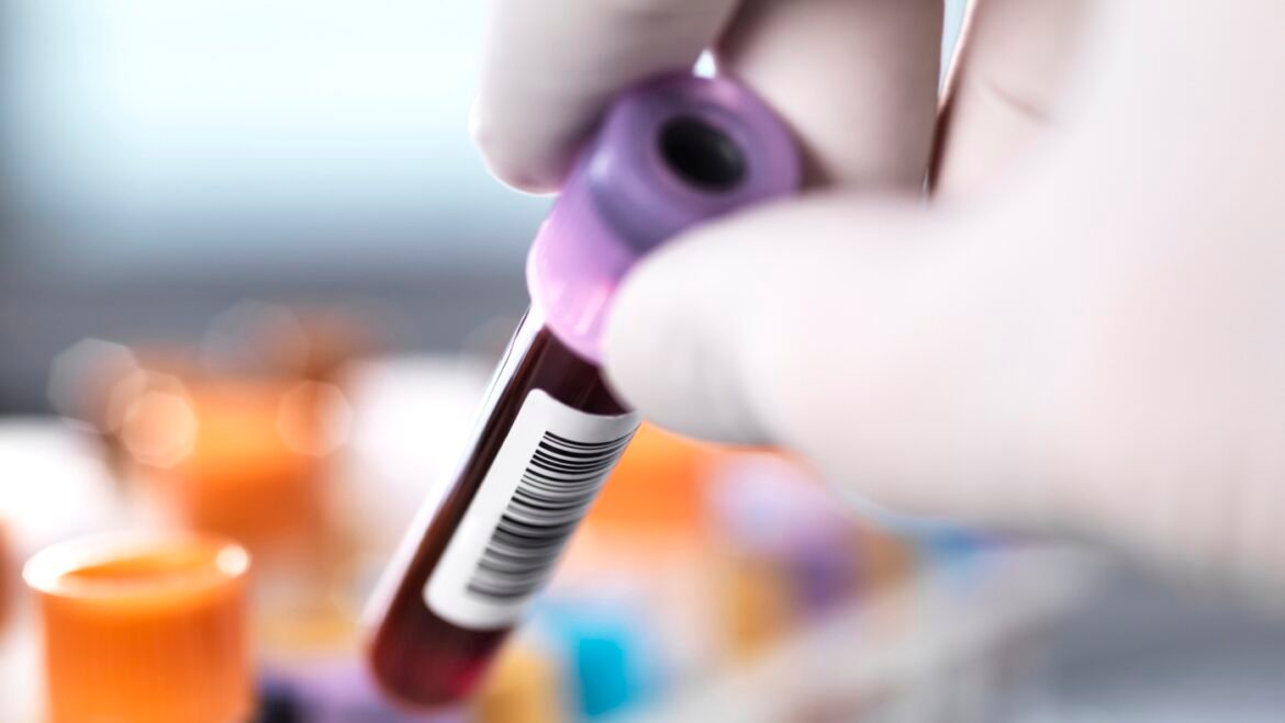 CRISPR gene-editing works to reduce high cholesterol in a new study : NPR