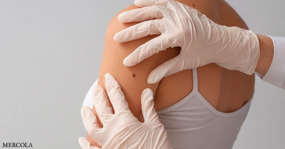 Niacinamide Found to Reduce the Risk of New Skin Cancers