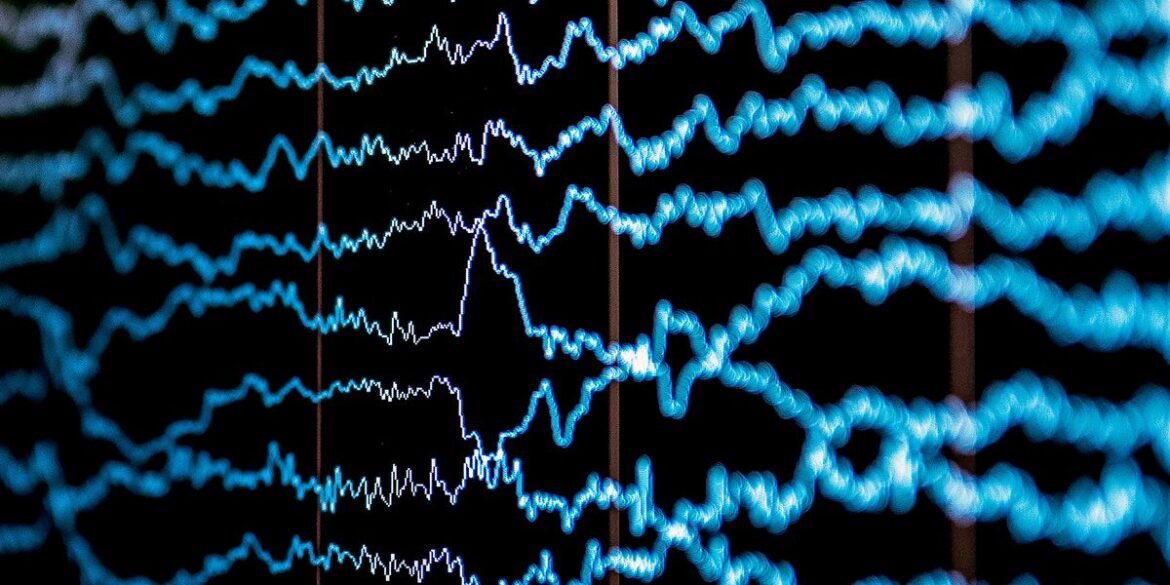 Tech Shares Pain Perception Measured by Brain Waves