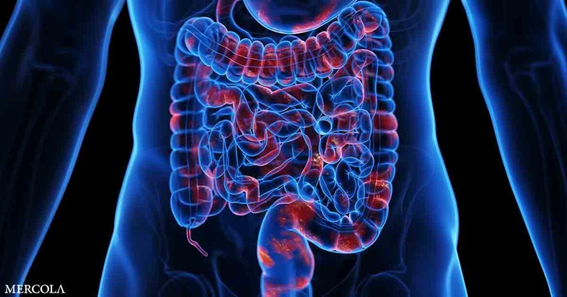 Toxic Chemicals in Food and Water Disrupt Your Gut Microbiome and Fuel Antibiotic Resistance