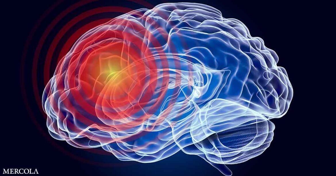 The Impact of Stroke on Speech Comprehension