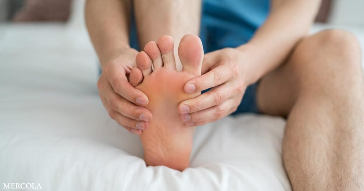How to Eliminate Athlete's Foot Naturally and Keep It from Returning