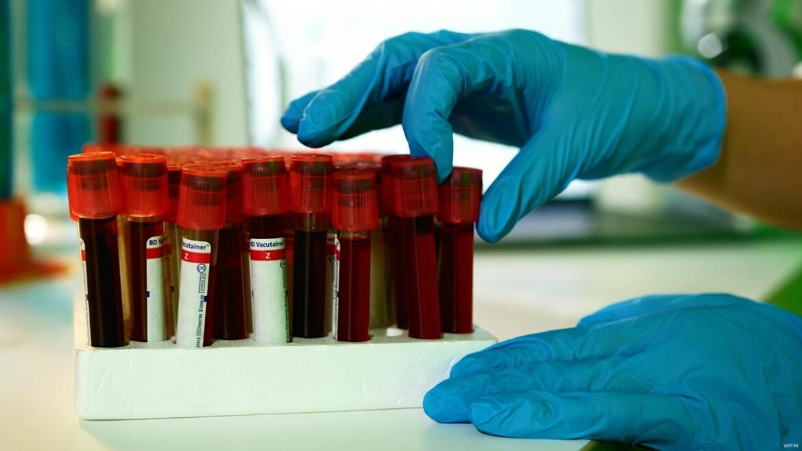 Why Understanding Lab Results Is Essential for Better Health Decisions