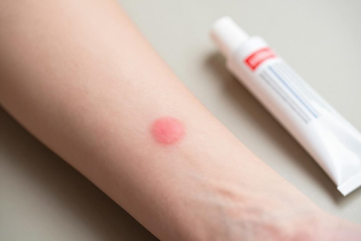 Ringworm Treatment: What Actually Works and What to Avoid